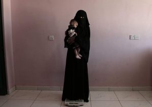 United Nations Warns 10 Million More Yemenis Expected to Starve to Death by End of Year: U.S. Backed Coalition to Blame
