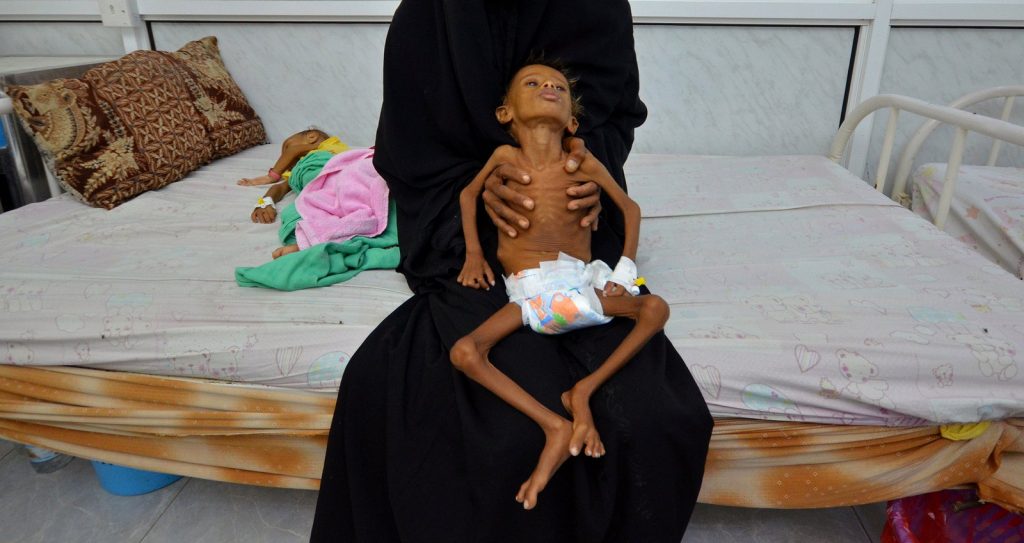 United Nations Warns 10 Million More Yemenis Expected to Starve to Death by End of Year: U.S. Backed Coalition to Blame