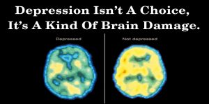 New Research Says Depression is Not a Choice, It's a Form of Brain Damage
